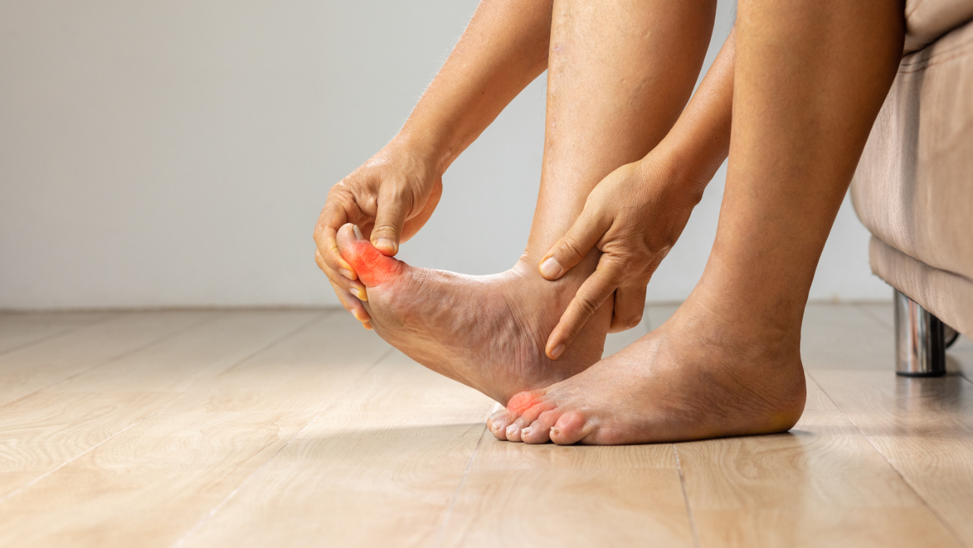 Foot with highlighted pain points for article give gout the boot blog article